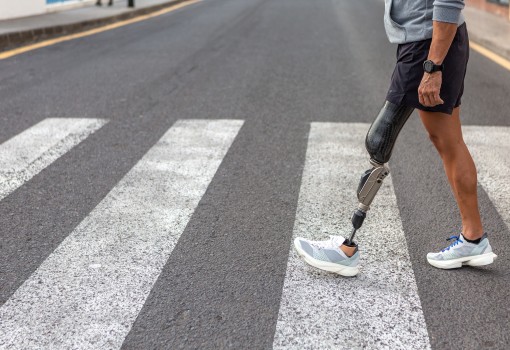 3D3P: Promoting Inclusion for People with Full or Partial Limb Loss