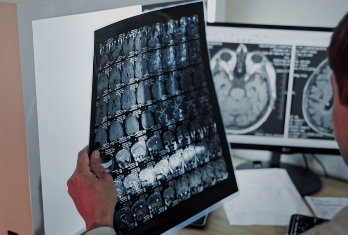 Someone holding image of a brain scan
